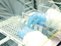 KBZ dobija novu TB laboratoriju